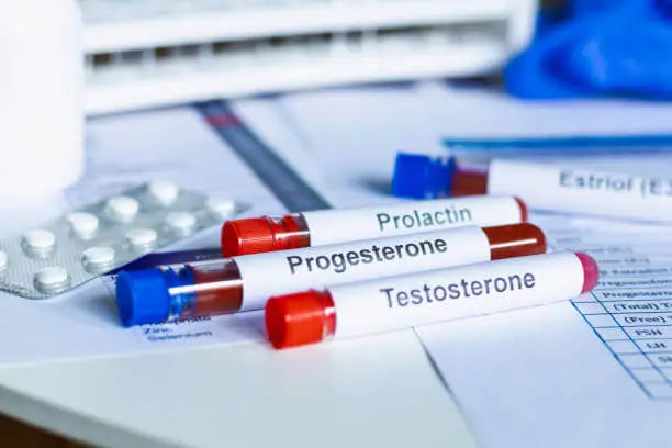 Bioidentical Progesterone: What It Is and Who Can Benefit From It